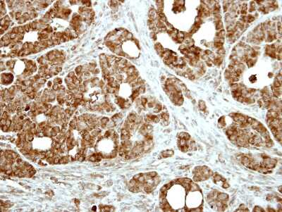 Immunohistochemistry-Paraffin: FAIM1 Antibody [NBP1-32987]