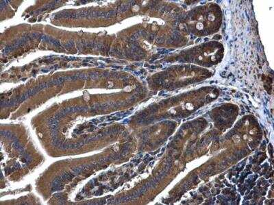 Immunohistochemistry-Paraffin: FAIM1 Antibody [NBP1-32987]