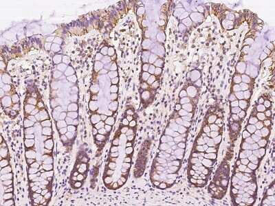 Immunohistochemistry-Paraffin: FAIM1 Antibody [NBP2-97561]