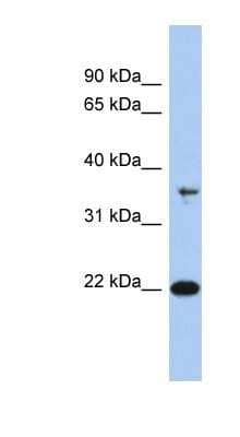 Western Blot: FAIM1 Antibody [NBP1-55209]