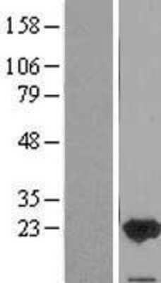 Western Blot: FAIM1 Overexpression Lysate [NBP2-11601]