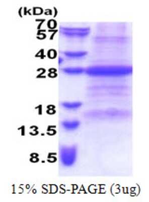 SDS-PAGE: Recombinant Human FAIM1 His Protein [NBP2-23038]