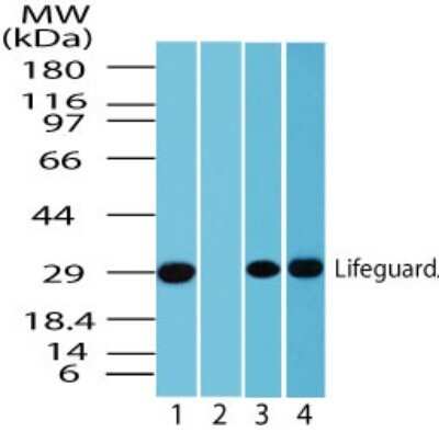 Western Blot: FAIM2 AntibodyAzide Free [NBP2-33257]