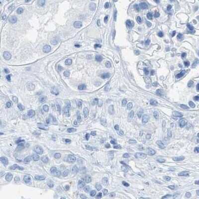 Immunohistochemistry-Paraffin: FAIM2 Antibody [NBP1-81456]