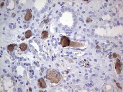 Immunohistochemistry: FAIM3 Antibody (OTI1E6) [NBP2-45575]
