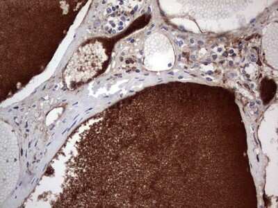 Immunohistochemistry: FAIM3 Antibody (OTI1E6) [NBP2-45575]