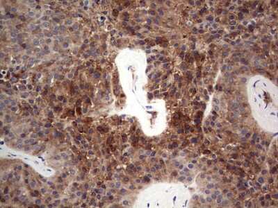 Immunohistochemistry: FAIM3 Antibody (OTI1E6) [NBP2-45575]