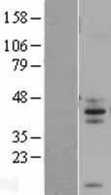 Western Blot: FAIM3 Overexpression Lysate [NBL1-10433]