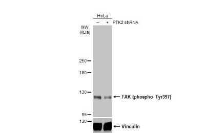 Western Blot: FAK [p Tyr397] Antibody [NBP3-12897]