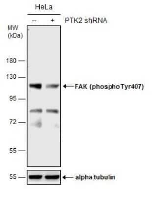 Western Blot: FAK [p Tyr407] Antibody [NBP3-13085]