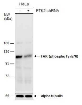 Western Blot: FAK [p Tyr576] Antibody [NBP3-13071]