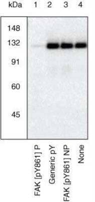 Western Blot: FAK [p Tyr861] Antibody [NBP2-68146]