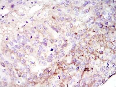 Immunohistochemistry-Paraffin: FAK Antibody (10H7) - BSA Free [NBP2-22168]