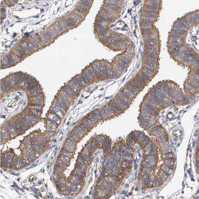 Immunohistochemistry-Paraffin: FAK Antibody [NBP1-84750]