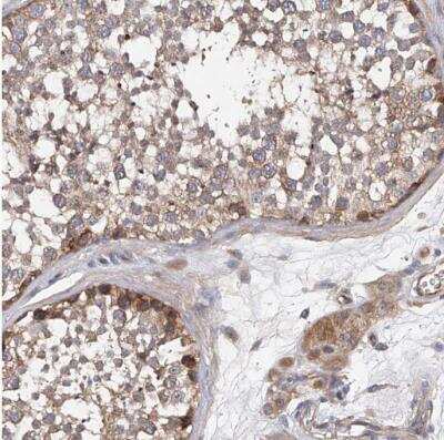 Immunohistochemistry-Paraffin: FAK Antibody [NBP1-84750]