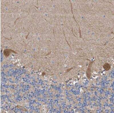 Immunohistochemistry-Paraffin: FAK Antibody [NBP1-84750]