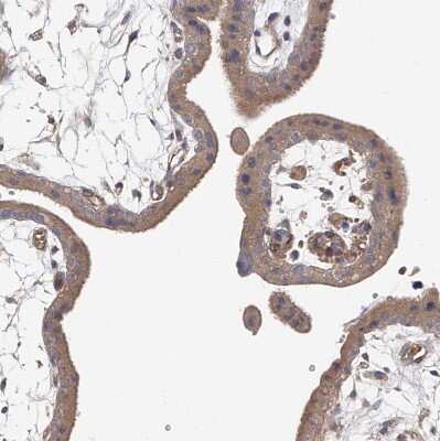 Immunohistochemistry-Paraffin: FAK Antibody [NBP1-84750]