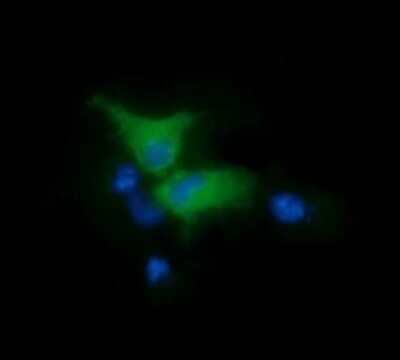 Immunocytochemistry/ Immunofluorescence: FAK Antibody (OTI4D11) - Azide and BSA Free [NBP2-71268]