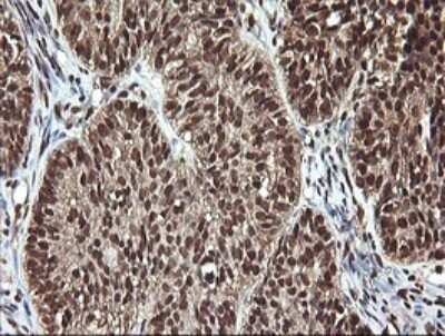 Immunohistochemistry: FAK Antibody (OTI4D11) - Azide and BSA Free [NBP2-71268]
