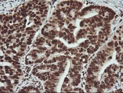 Immunohistochemistry: FAK Antibody (OTI4D11) - Azide and BSA Free [NBP2-71268]
