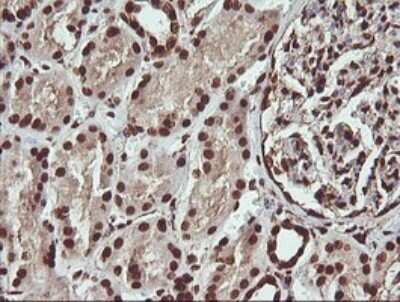 Immunohistochemistry: FAK Antibody (OTI4D11) - Azide and BSA Free [NBP2-71268]