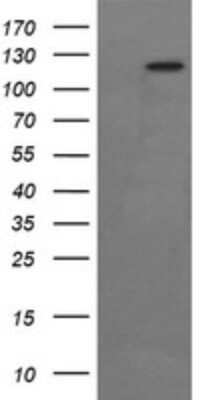 Western Blot: FAK Antibody (OTI4D11)Azide and BSA Free [NBP2-71268]