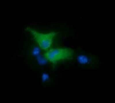 Immunocytochemistry/ Immunofluorescence: FAK Antibody (OTI4D11) [NBP2-45923]