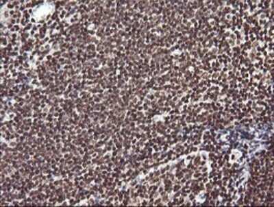 Immunohistochemistry: FAK Antibody (OTI4D11) [NBP2-45923]