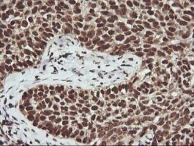 Immunohistochemistry: FAK Antibody (OTI4D11) [NBP2-45923]