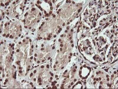 Immunohistochemistry: FAK Antibody (OTI4D11) [NBP2-45923]