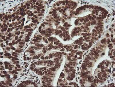 Immunohistochemistry: FAK Antibody (OTI4D11) [NBP2-45923]