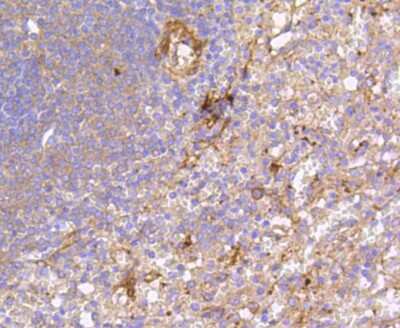 Immunohistochemistry-Paraffin: FAK Antibody (SR46-04) [NBP2-67327]
