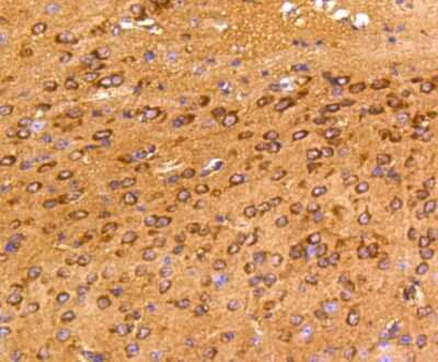 Immunohistochemistry-Paraffin: FAK Antibody (SR46-04) [NBP2-67327]
