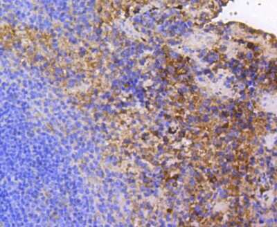 Immunohistochemistry-Paraffin: FAK Antibody (SR46-04) [NBP2-67327]