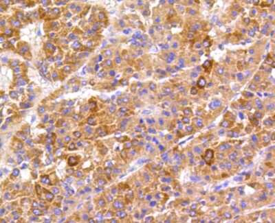 Immunohistochemistry-Paraffin: FAK Antibody (SR46-04) [NBP2-67327]