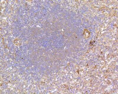 Immunohistochemistry-Paraffin: FAK Antibody (SR46-04) [NBP2-67327]