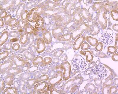 Immunohistochemistry-Paraffin: FAK Antibody (SR46-04) [NBP2-67327]