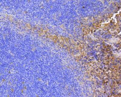 Immunohistochemistry-Paraffin: FAK Antibody (SR46-04) [NBP2-67327]