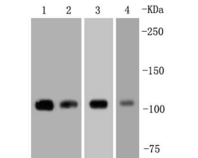 Western Blot: FAK Antibody (SR46-04) [NBP2-67327]