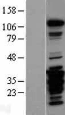 Western Blot: FAK Overexpression Lysate [NBL1-14951]