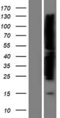 Western Blot: FAK Overexpression Lysate [NBP2-10456]