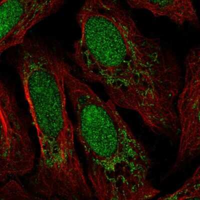 Immunocytochemistry/ Immunofluorescence: FAKD3 Antibody [NBP2-57374]