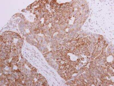 Immunohistochemistry-Paraffin: FAKD3 Antibody [NBP1-33138]
