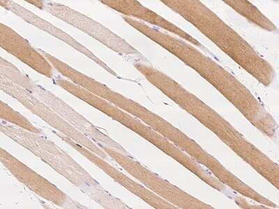 Immunohistochemistry-Paraffin: FAKD3 Antibody [NBP2-97546]