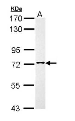 Western Blot: FAKD3 Antibody [NBP1-33138]