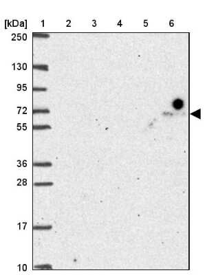 Western Blot: FAKD3 Antibody [NBP2-39095]