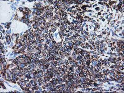 Immunohistochemistry-Paraffin: FALDH Antibody (OTI2A7) [NBP2-01017]