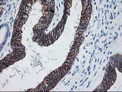Immunohistochemistry-Paraffin: FALDH Antibody (OTI2A7) [NBP2-01017]
