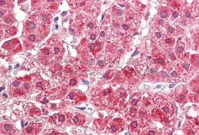 Immunohistochemistry: FALDH Antibody [NBP1-59679]