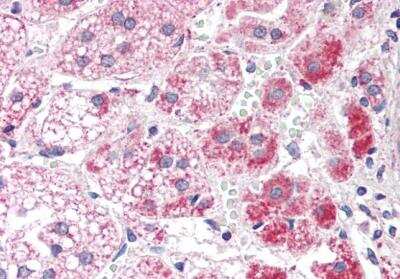 Immunohistochemistry-Paraffin: FALDH Antibody [NBP1-52056]